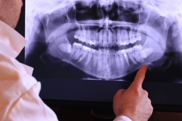 Best 24-Hour Emergency Dentist in Park Forest, IL