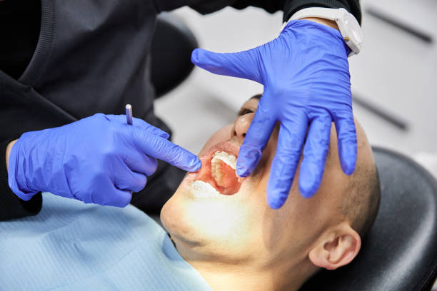 Best Emergency Root Canal Treatment in Park Forest, IL