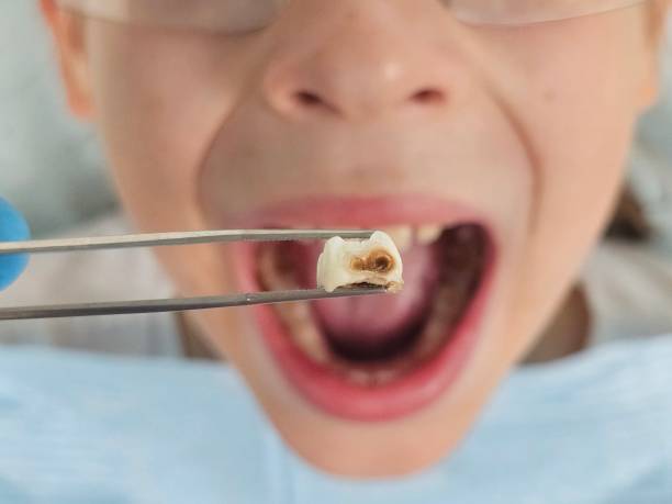 Best Pediatric Emergency Dentist in Park Forest, IL