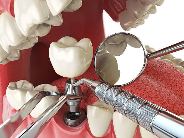 Best Emergency Dentist for Knocked-Out Tooth in Park Forest, IL