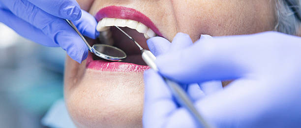Best Emergency Dental Extractions in Park Forest, IL